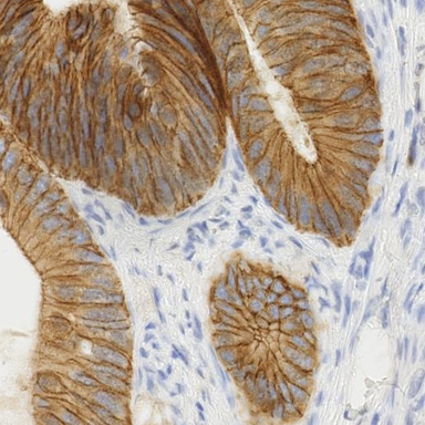 immunohistochemistry source image