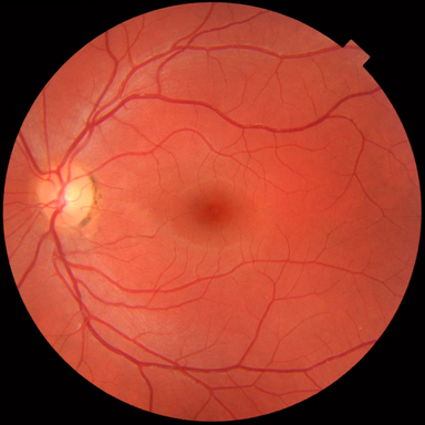 retina source image